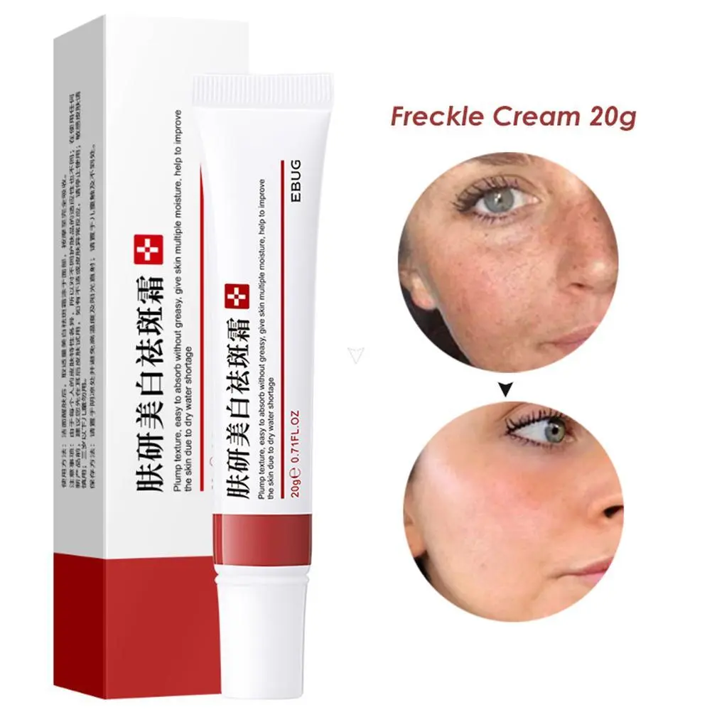 Acne Removal Cream Oil Control Acne Fade Acne Spots Shrink Pores Whitening Moisturizing Acne Cream Skin Care