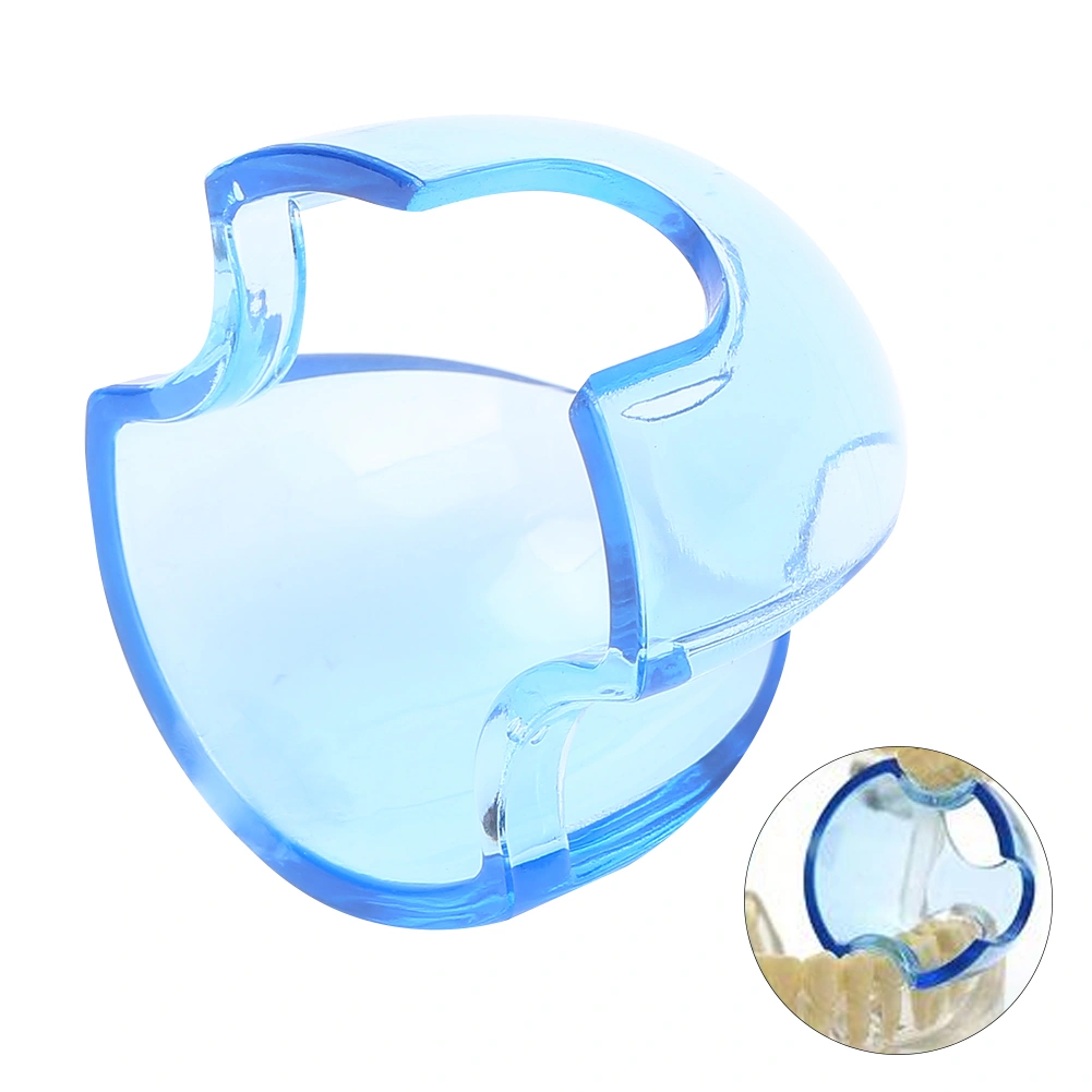 5pcs Mouth Opener Dental Orthodontic Lip Cheek Retractor Expander Dental Mouth AccessoryTransparent Blue