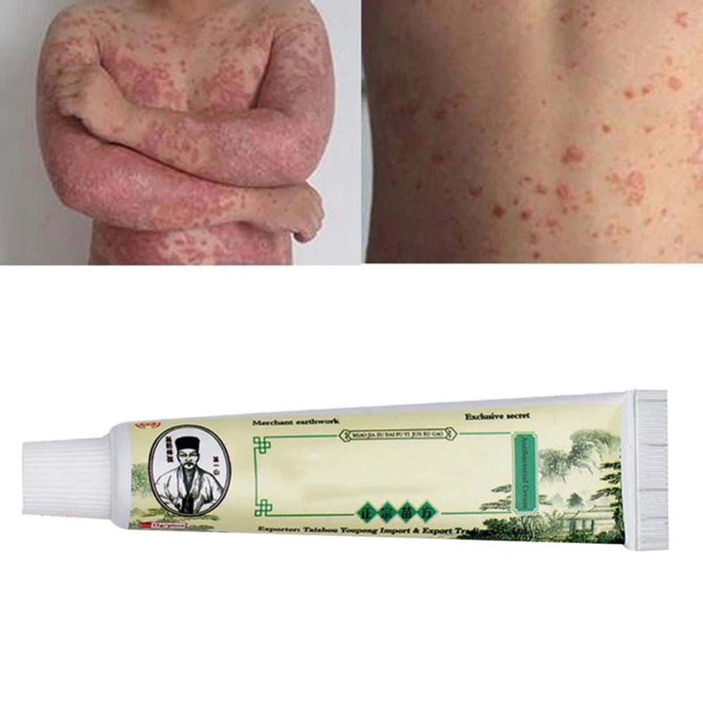 15g Chinese Herbal Psoriasis Skin Care Dermatitis Eczema Pruritus Psoriasis Cream Ointment