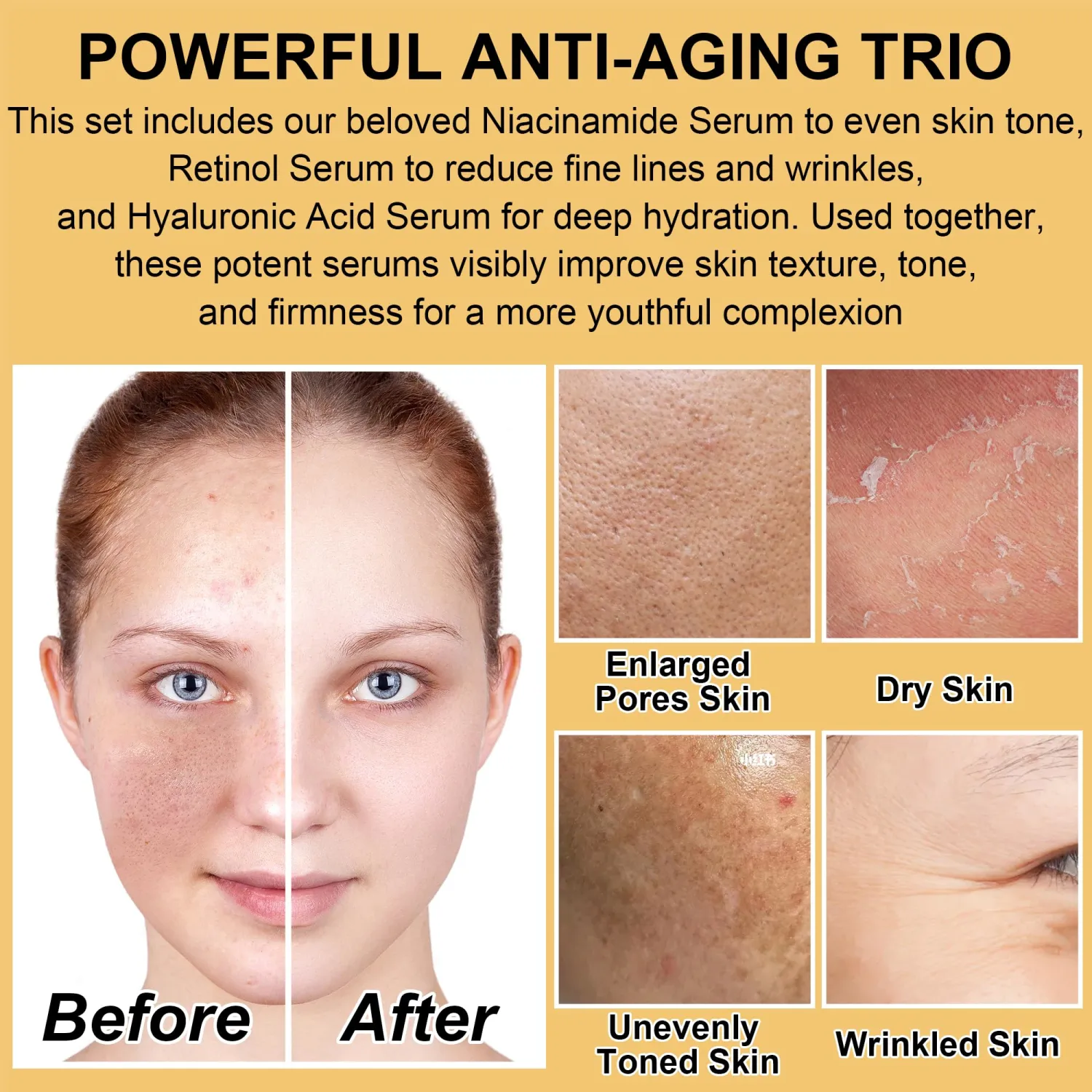 Professional Anti-Aging Skin Care Set Kit for Women Teens,Niacinamide Retinol Serum,Hylunaric Acid Serum,Skincare Gift Set,Facial Skin Care Products,Face Care Routine Kit Christmas Gift Women