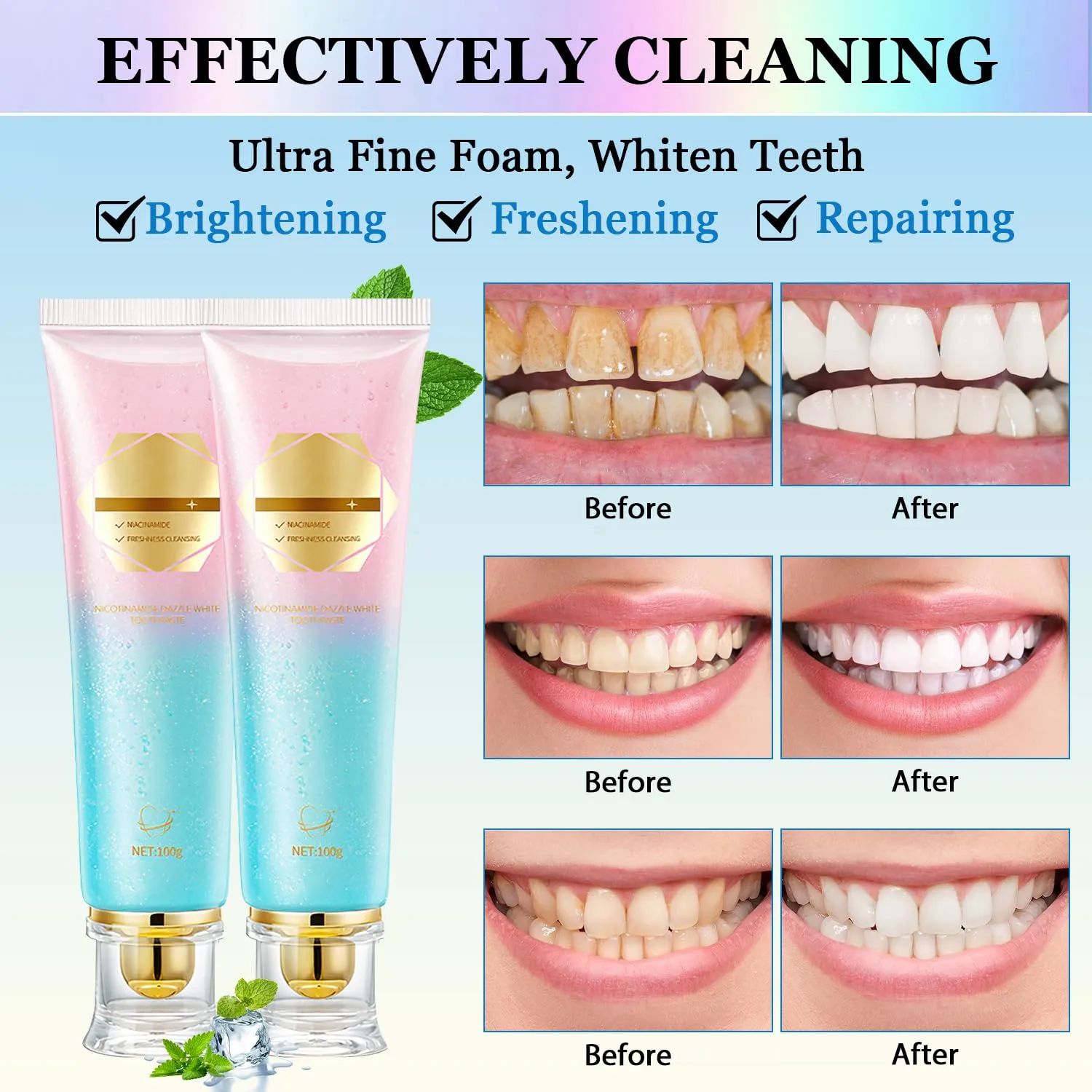 2Pcs Acssart Radiant Whitening Toothpaste, Niacinamide Intensive White Toothpastes, Nicotinamide White Toothpastes, Deep Cleaning Care