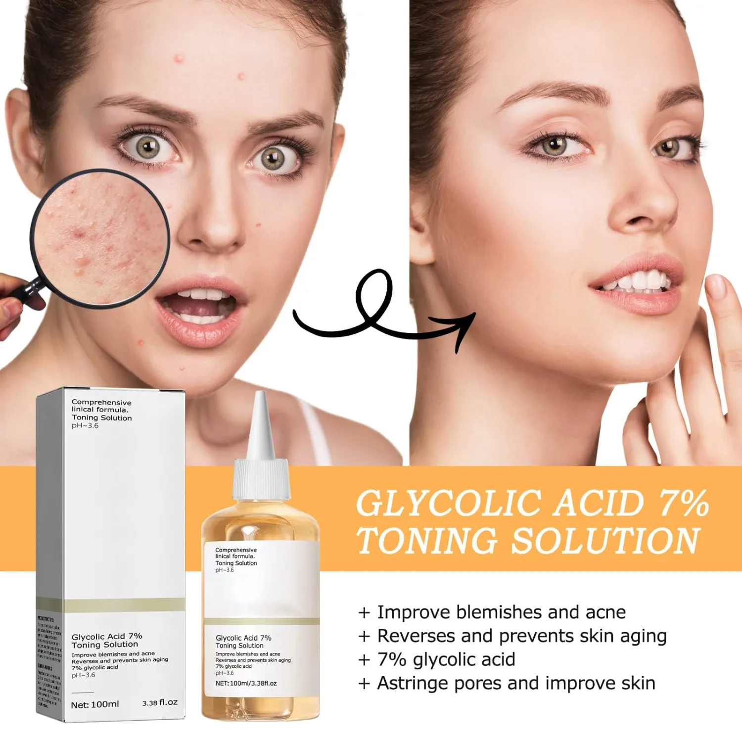 Glycolic Acid Toning Solution, Glycolic Acid 7% Toner, Glycolic Sour 7% Toning, KeepThe Skin Moist, Exfoliating Serum for Face, Facial Exfoliation Astringe Pores (100ML/3.38 Fl Oz)