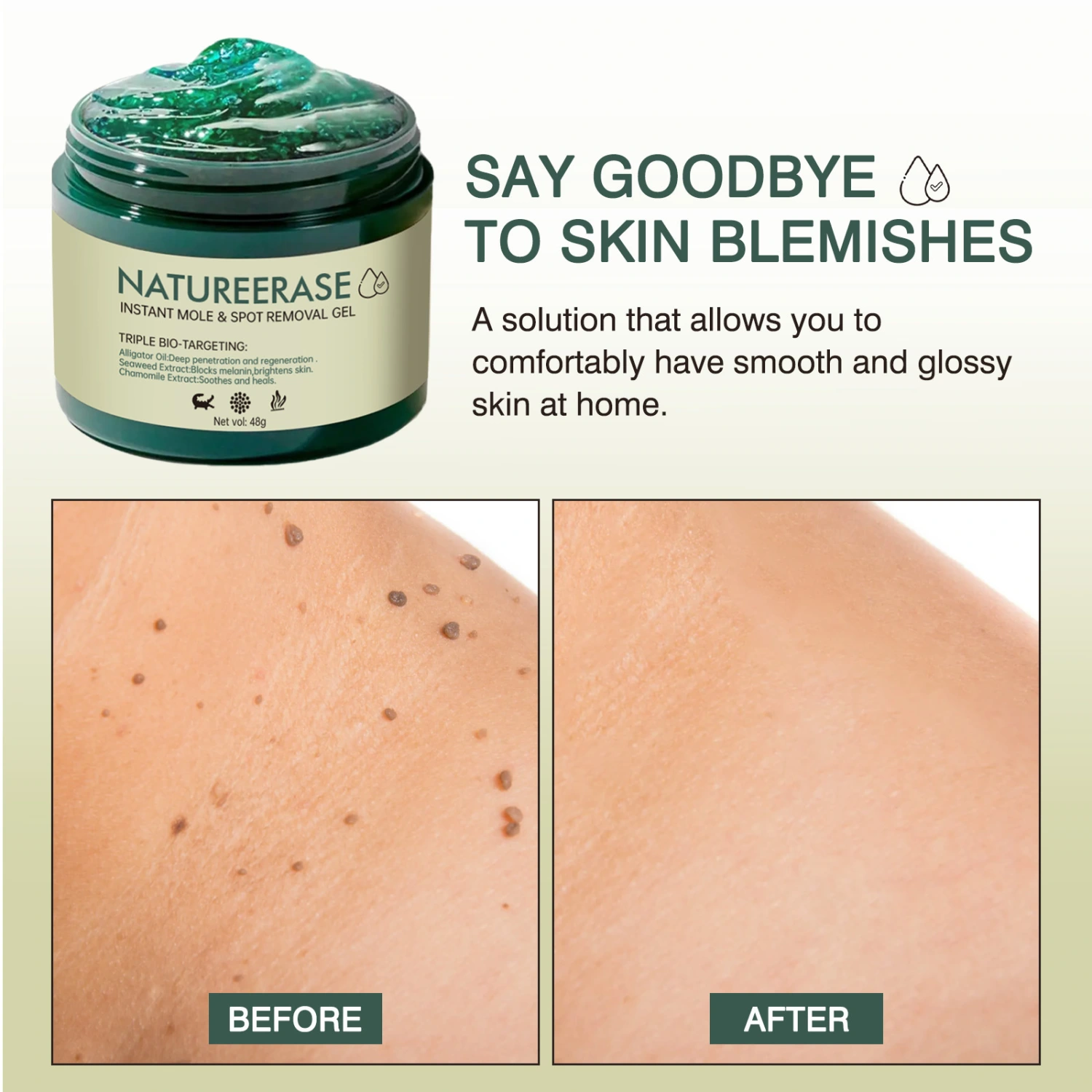 Mole Spot Removal Gel Reduces Dull Blemishes Mild Formula