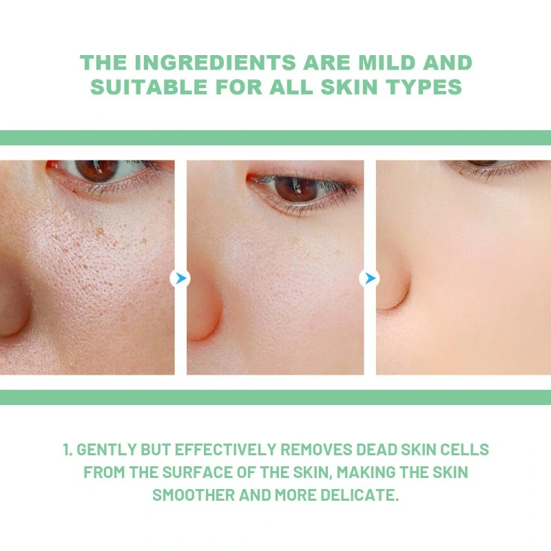 Herbal Exfoliating Gel Gently Cleans Closed Mouth