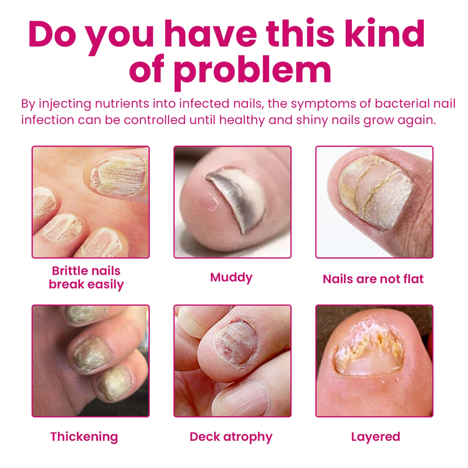 Moisturizing And Nourishing Nail Ginger Care Essence