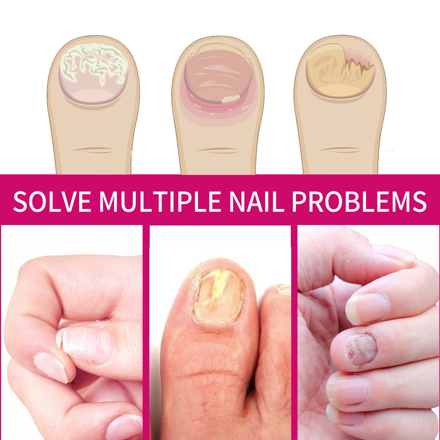 Moisturizing And Nourishing Nail Ginger Care Essence