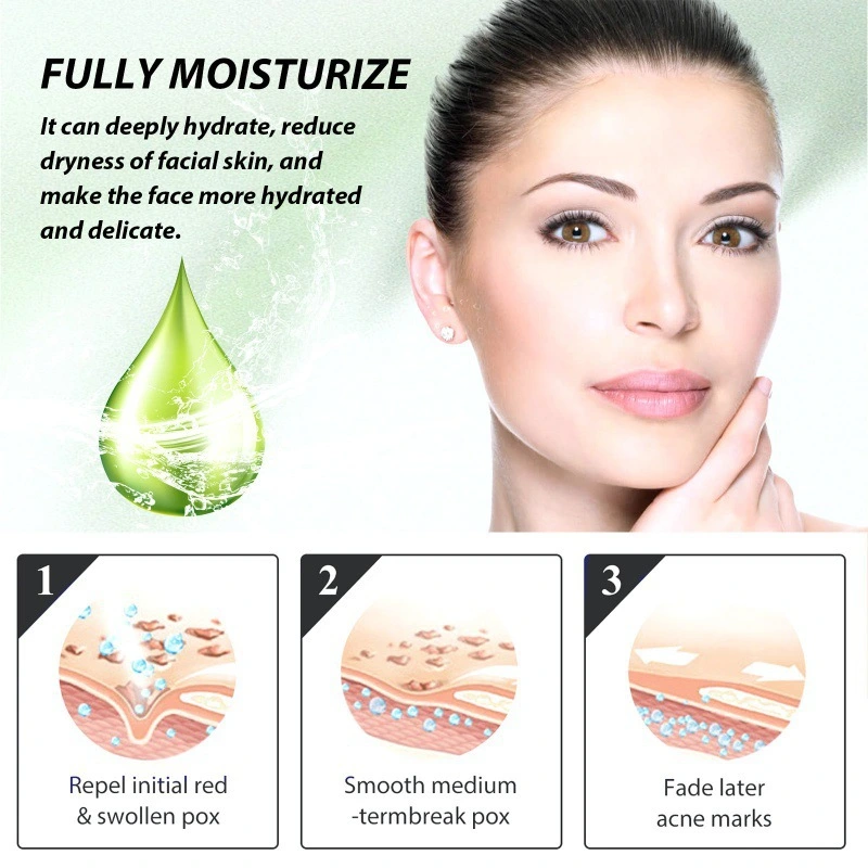 Facial Acne Removing Liquid