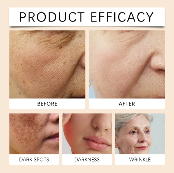 Anti Aging Face Cream