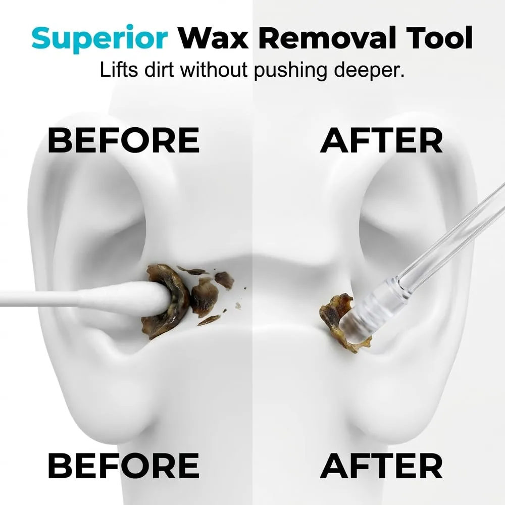 Earwax Removal Adhesive Swabs, 2026 New Reusable Sticky Earwax Removal Swabs, Ear Wax Removal Tools with Dust Cover Packaging, Safe Ear Cleaning Sticks for Adults (24pcs(1 Box), Large)