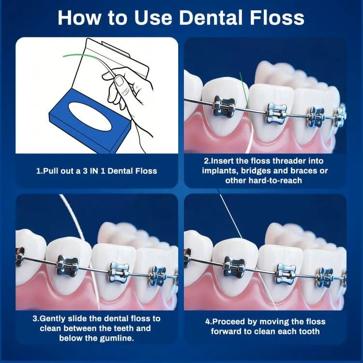 3-in-1 Ultimate Floss with Threaders,PTFE & PFAS-Free,160 Count Expanding Dental Floss for Braces,Bridges & Wide Gaps