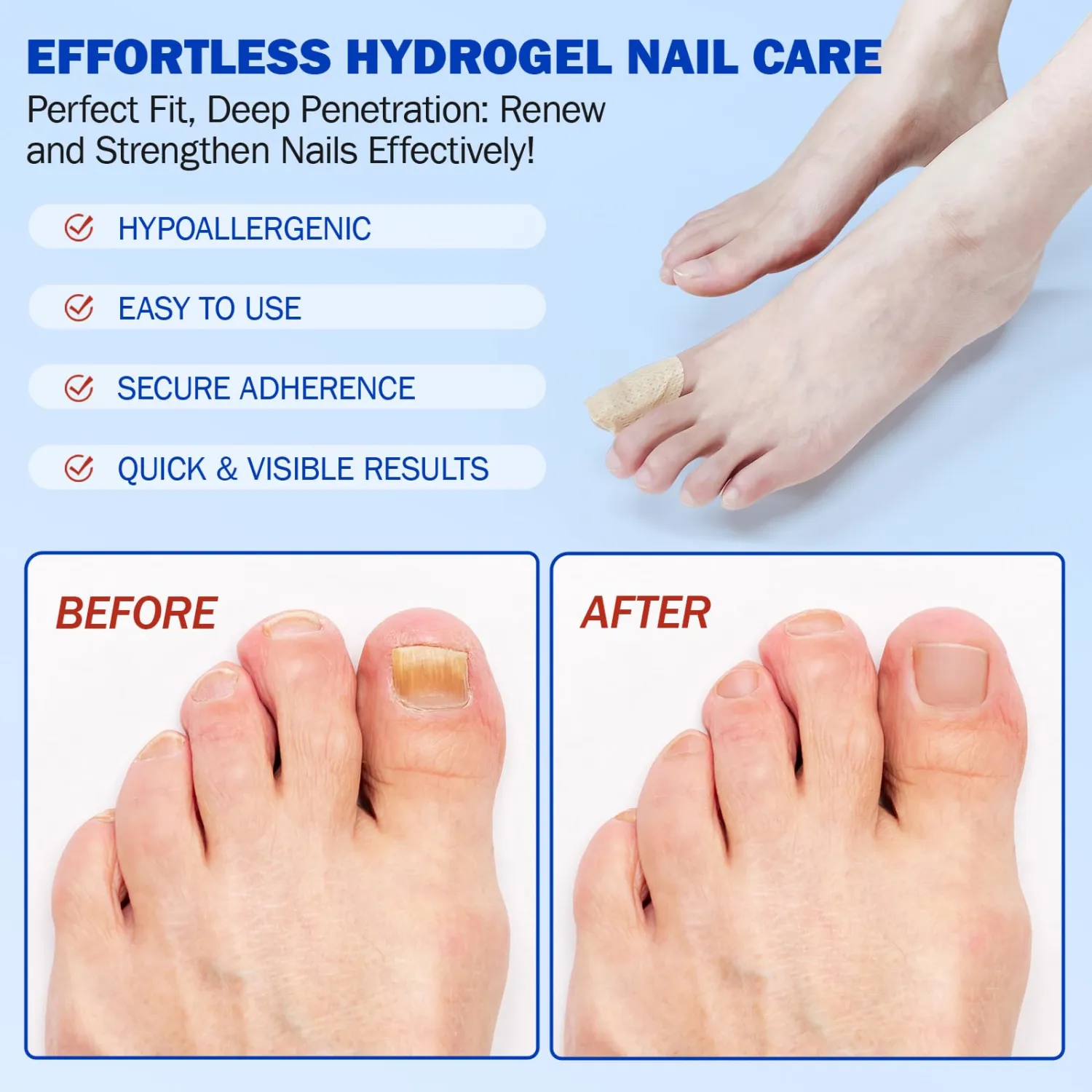 21 Pcs Nail Repair Patches, 8 Hours Overnight Renewal for Thick, Brittle and Discolored Toe Nail, Repair & Strengthen Damaged Foot Nails