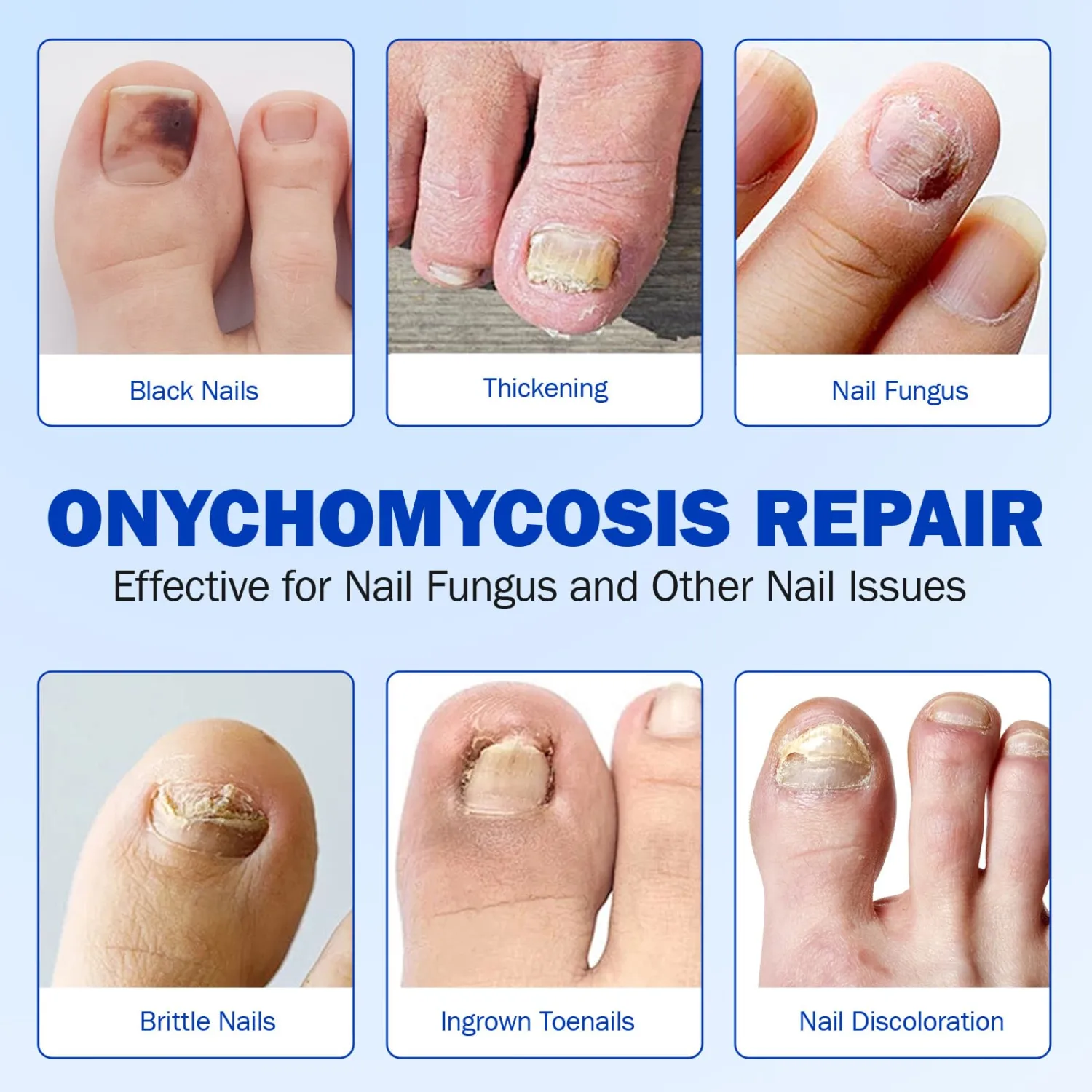 21 Pcs Nail Repair Patches, 8 Hours Overnight Renewal for Thick, Brittle and Discolored Toe Nail, Repair & Strengthen Damaged Foot Nails