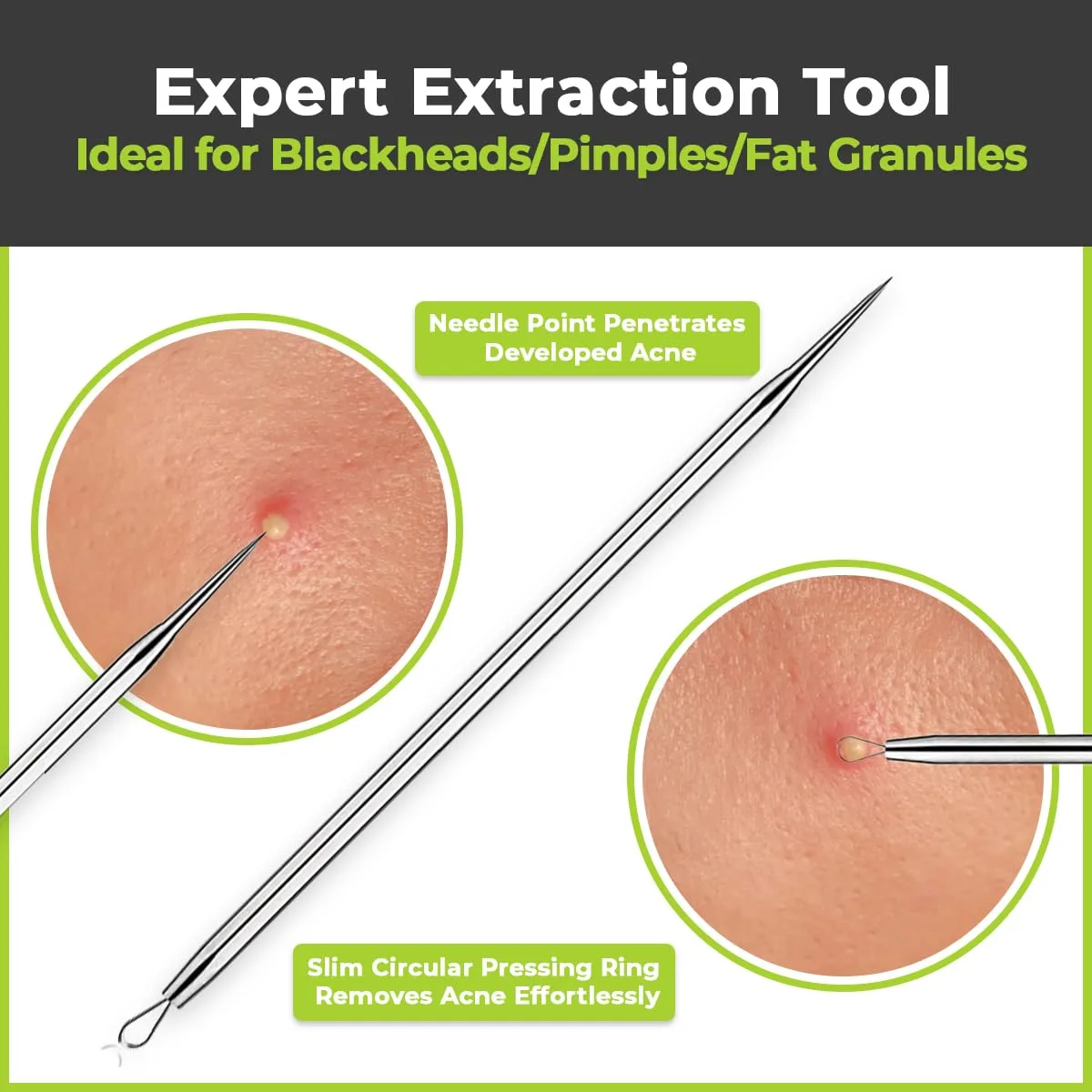 2 Pcs Pimple Extractor Tool 410 Grade Stainless Steel | Comedone Extractor, Pimple Popper, Blackhead Remover for Face, Zit Popper, Pimple Needle for Acne Removal