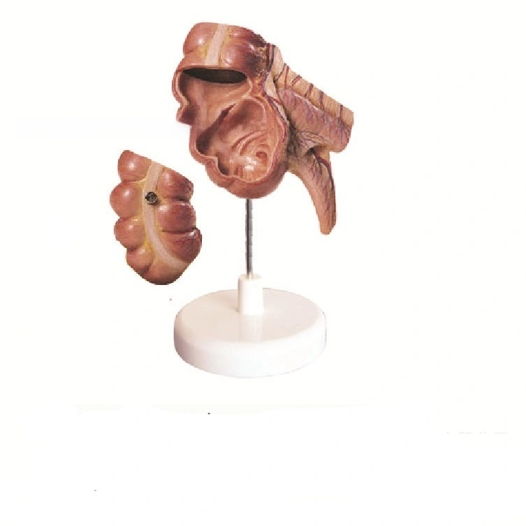 Anatomical Teaching Models Of The Appendix And Cecum