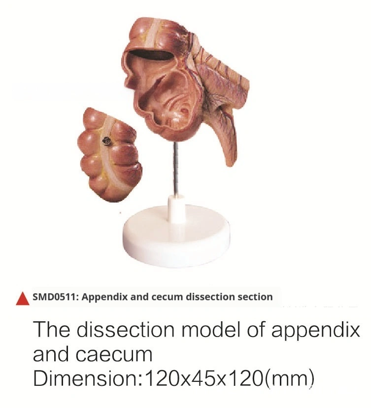 Anatomical Teaching Models Of The Appendix And Cecum