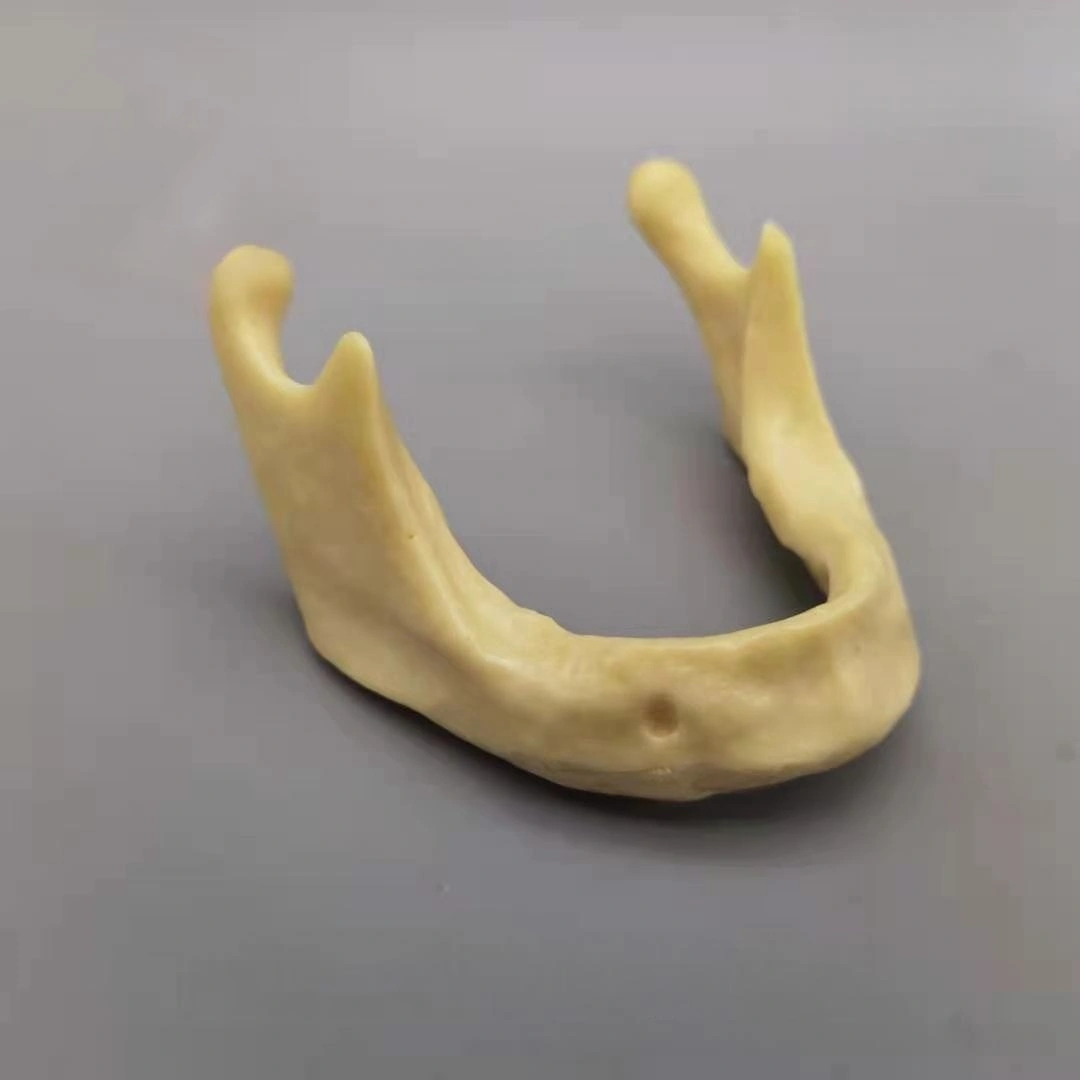 Dental Mandibular Implant Training Model