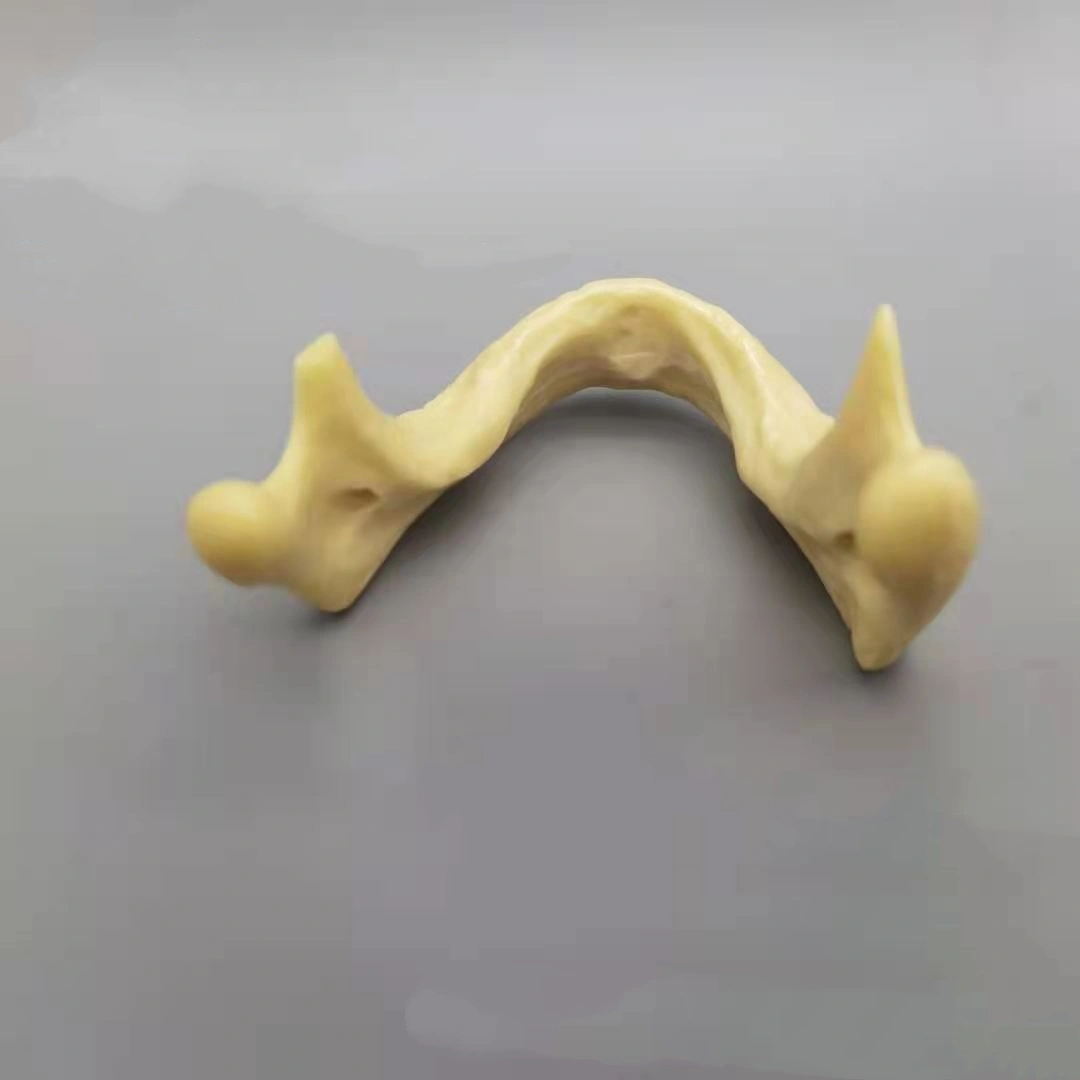 Dental Mandibular Implant Training Model