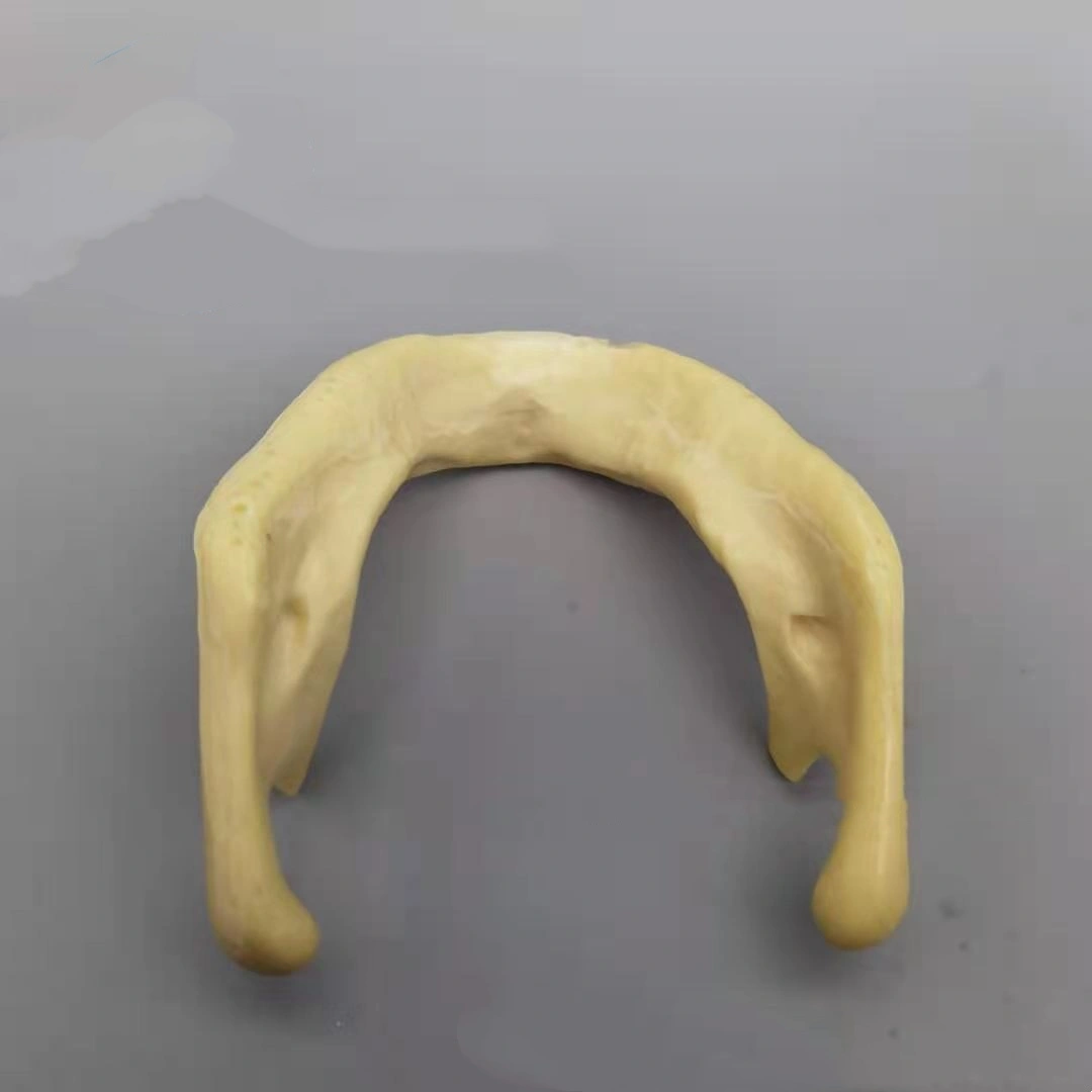 Dental Mandibular Implant Training Model