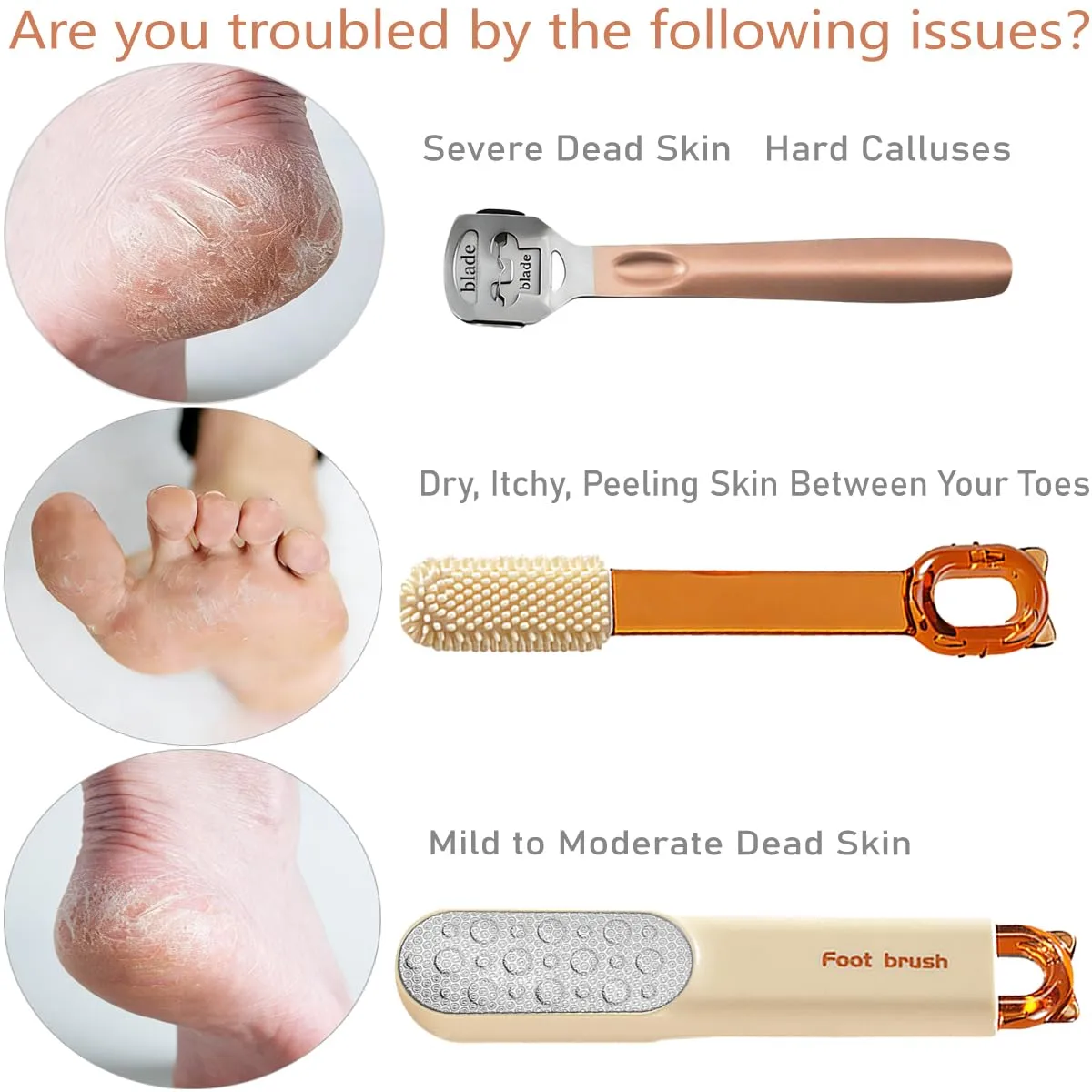 Dual-Sided Foot File-Callus Shaver with 21 Blades-Stainless Steel Foot Callus Remover & Foot Scrubber for Removing Calluses, Aged Keratin, Hard Dead Skin-Heel Scraper Pedicure Tool Kit
