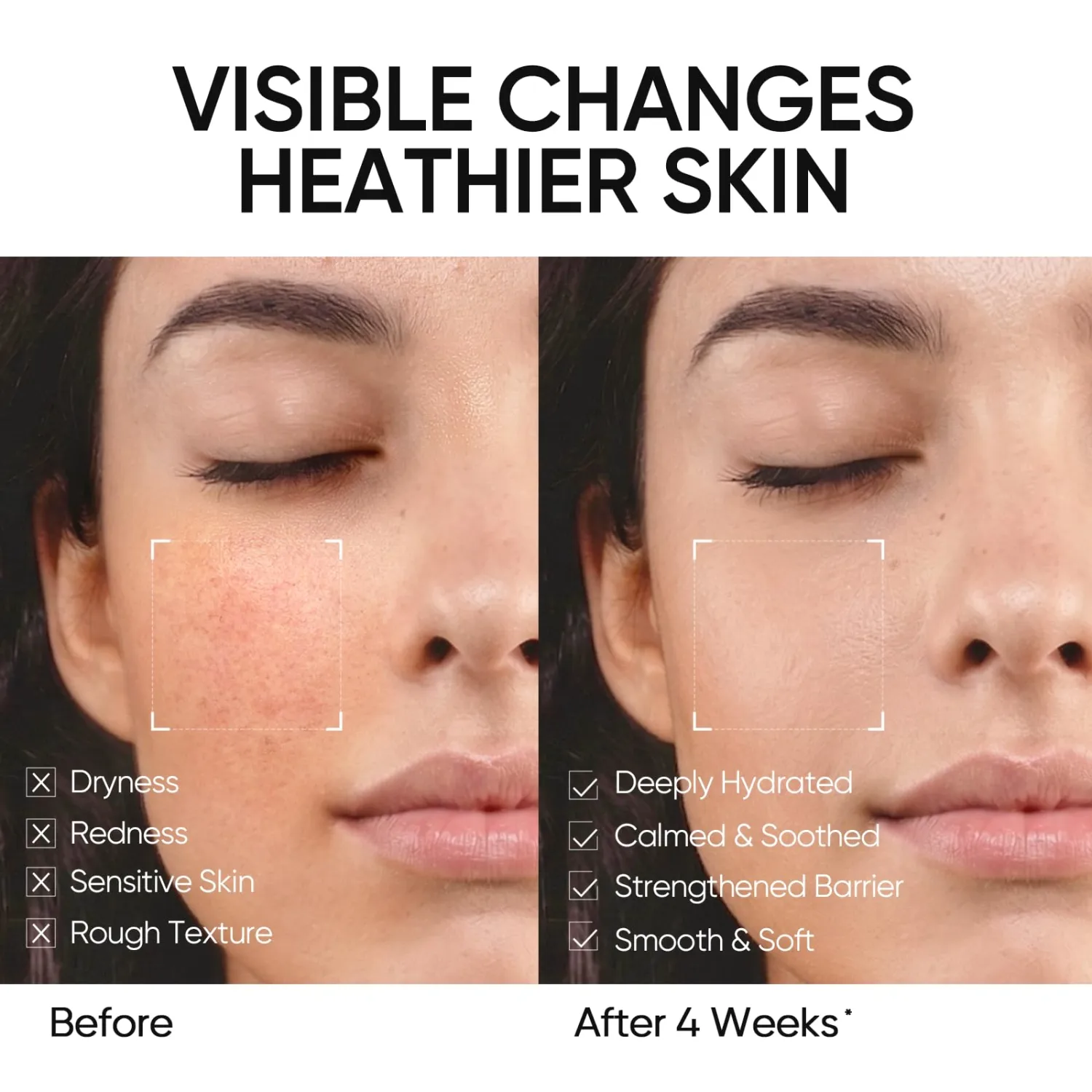Face Moisturizer with 5X Ceramides, Hydrating Moisture Barrier Repair Cream for Sensitive/Oil Skin Types, Hyaluronic Acid & Centella, Daily Facial Moisturizer, Non-Comedogenic 50g/1.76 OZ