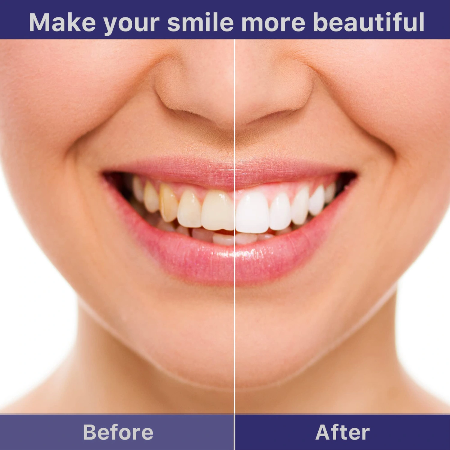 Tartar And Stain Removal Oral Cleaning Tooth Gel