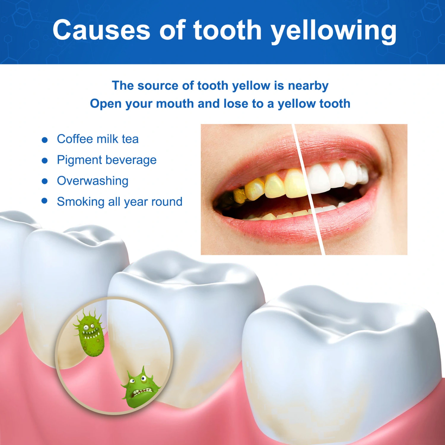 Tartar And Stain Removal Oral Cleaning Tooth Gel