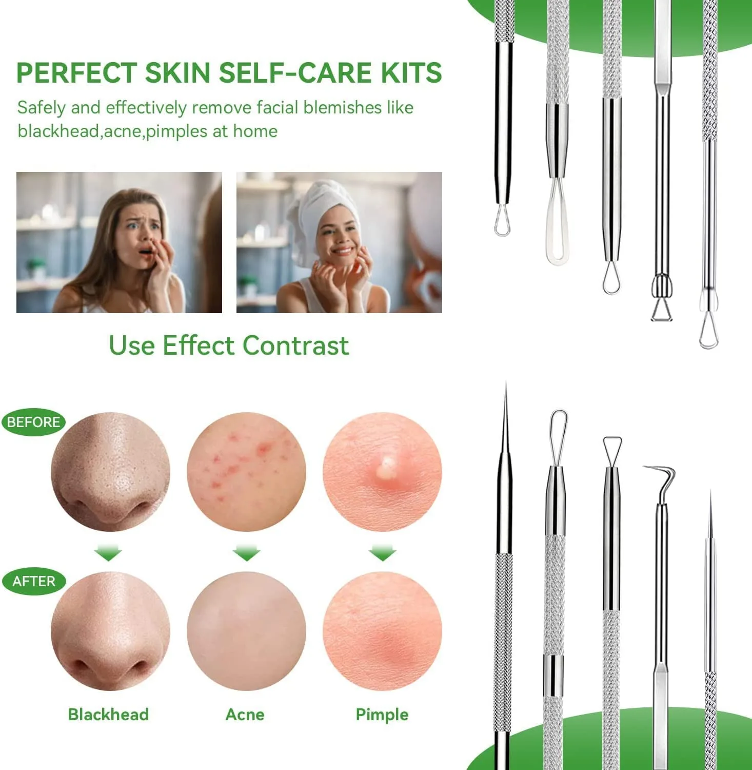 Pimple Popper Tool Kit,Blackhead Remover Tool 5 Pcs Blackhead Extractor Tool for Face Comedone Zit Acne Whitehead Blemish, Stainless Steel Extraction Tools Set