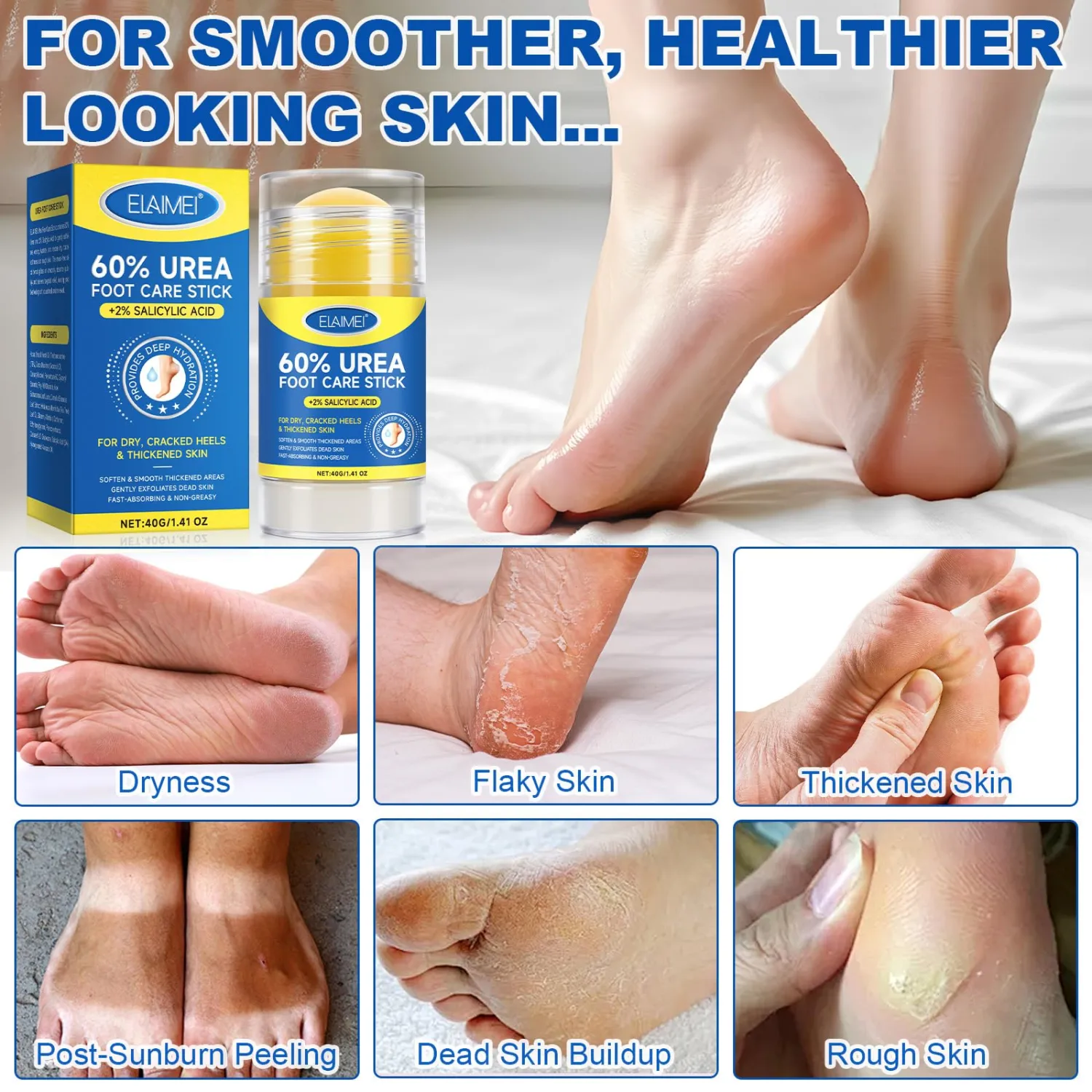 Urea Foot Care Cream, Urea Cream 60 Percent for Feet Maximum Strength with 2% Salicylic Acid, Foot Cream for Cracked Heels and Dry Skin, Cracked Heel Repair, Callus Remover, Deep Hydration, 1.41 Oz