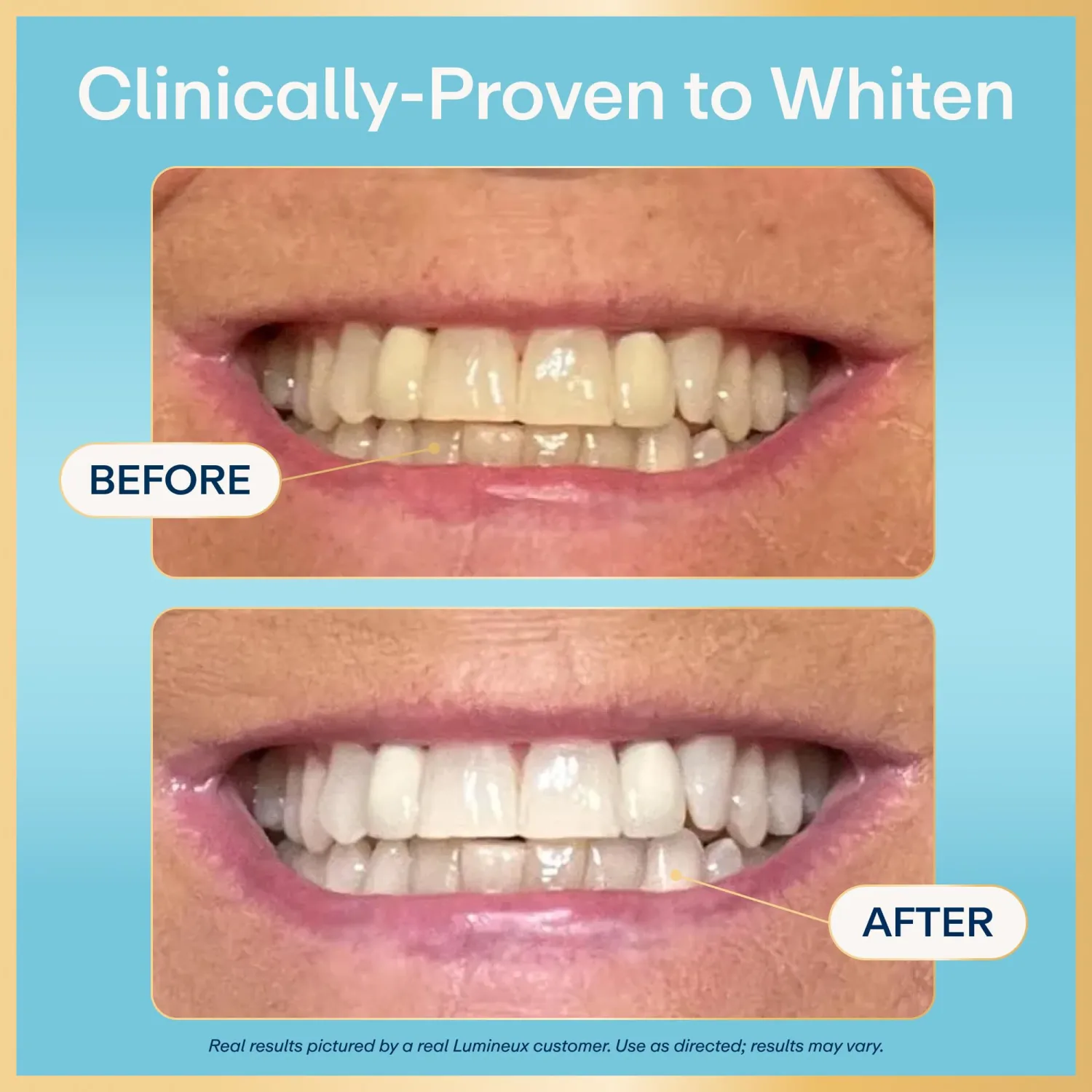 Lumineux 2-in-1 Whitening Pen Enamel Safe and Clinically Proven to Whiten Without The Sensitivity - Removes Coffee, Tea, and Smoking Stains