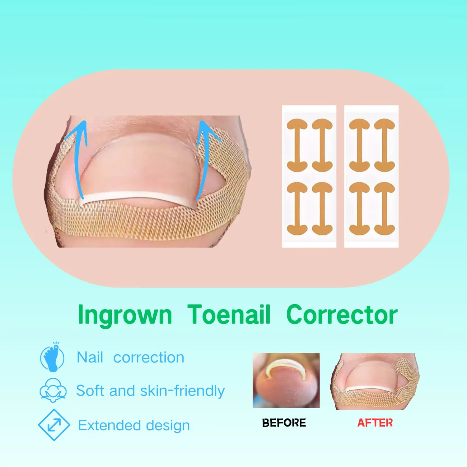 Ingrown Toenail Corrector Set with Curved Toenail Correction Patch, Upgraded Nail Removal Kit, Pedicure Tools for Home Treatment