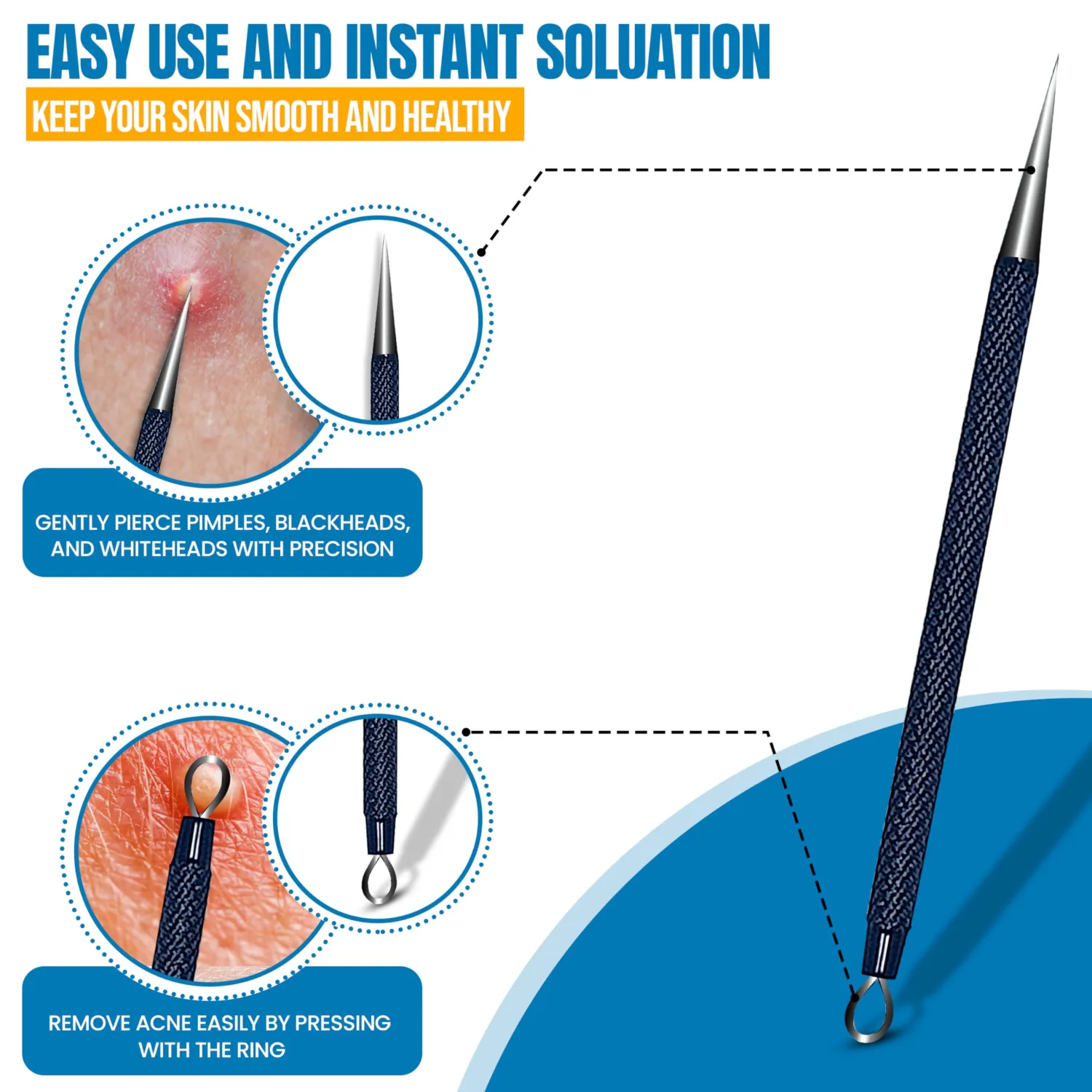 EFAH Care 2Pcs Stainless Steel Pimple Extractor Acne Treatment Tool Surgical Blemish Grade Blackhead Remover Perfect for face and Nose Easy to Clean (Black)