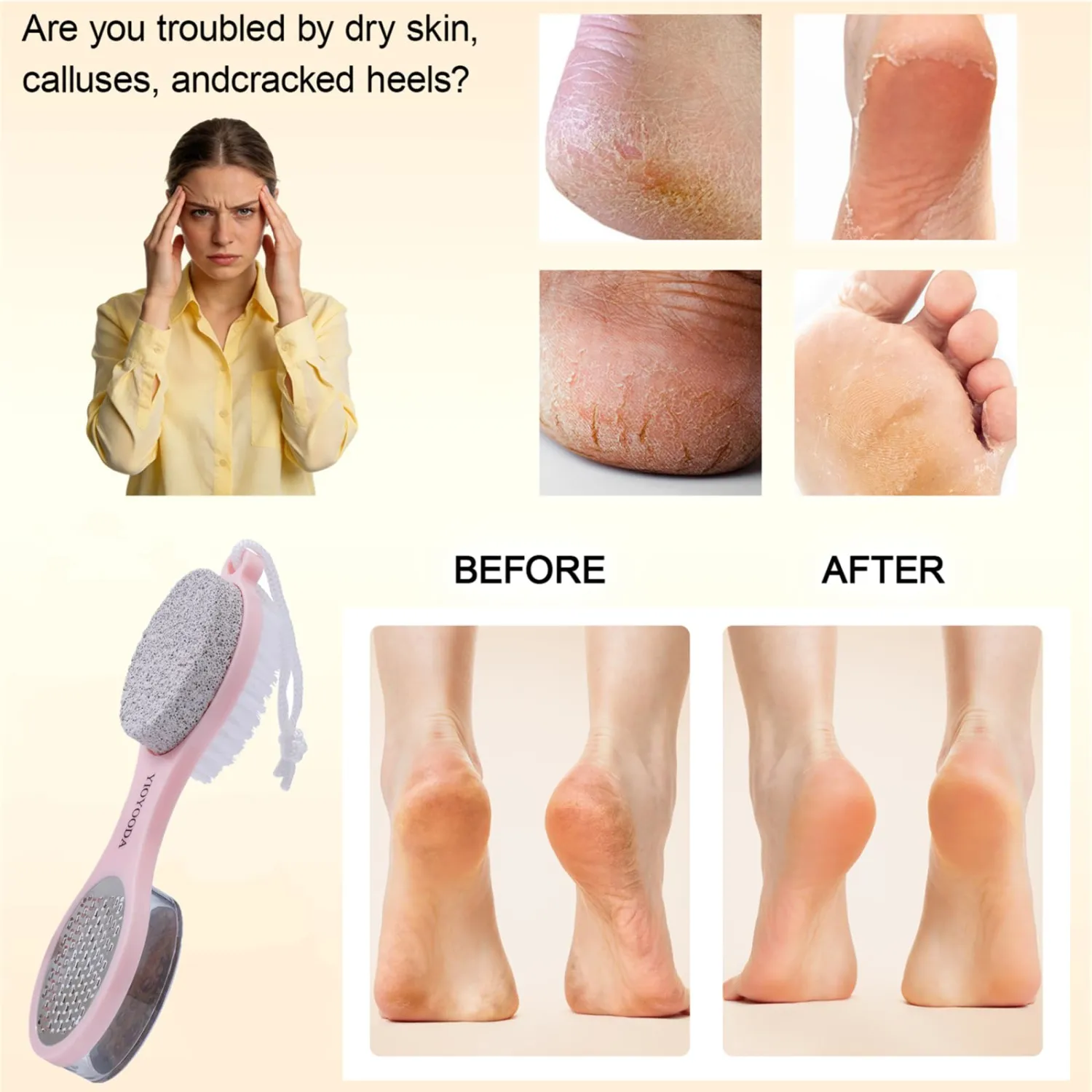 Foot File Callus Remover 5-in-1, 2 Pcs Feet Scraper Pedicure Tools with Pumice Stone, Scrubber Brush, Stainless Steel Foot Rasp and Sand Paper Debris Catcher, Multi Purpose, Pink