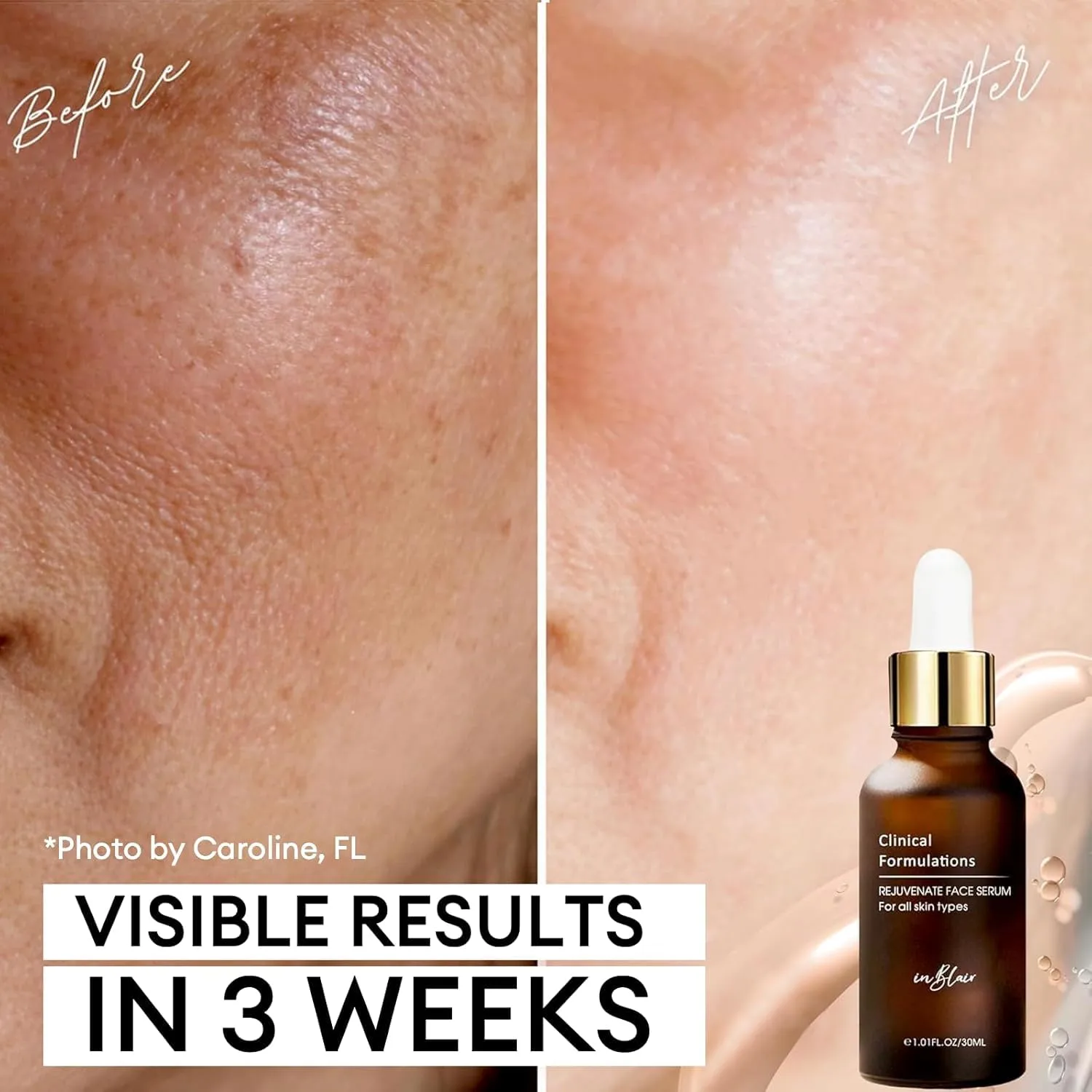 2 Bottle Pack - Inblair Rejuvenate Resurfacing Face Serum - Skin Care Serum for Face Wrinkles, Fine Lines, Dark Spots - Multi-Weight Hyaluronic Acid Formula for All Skin Types