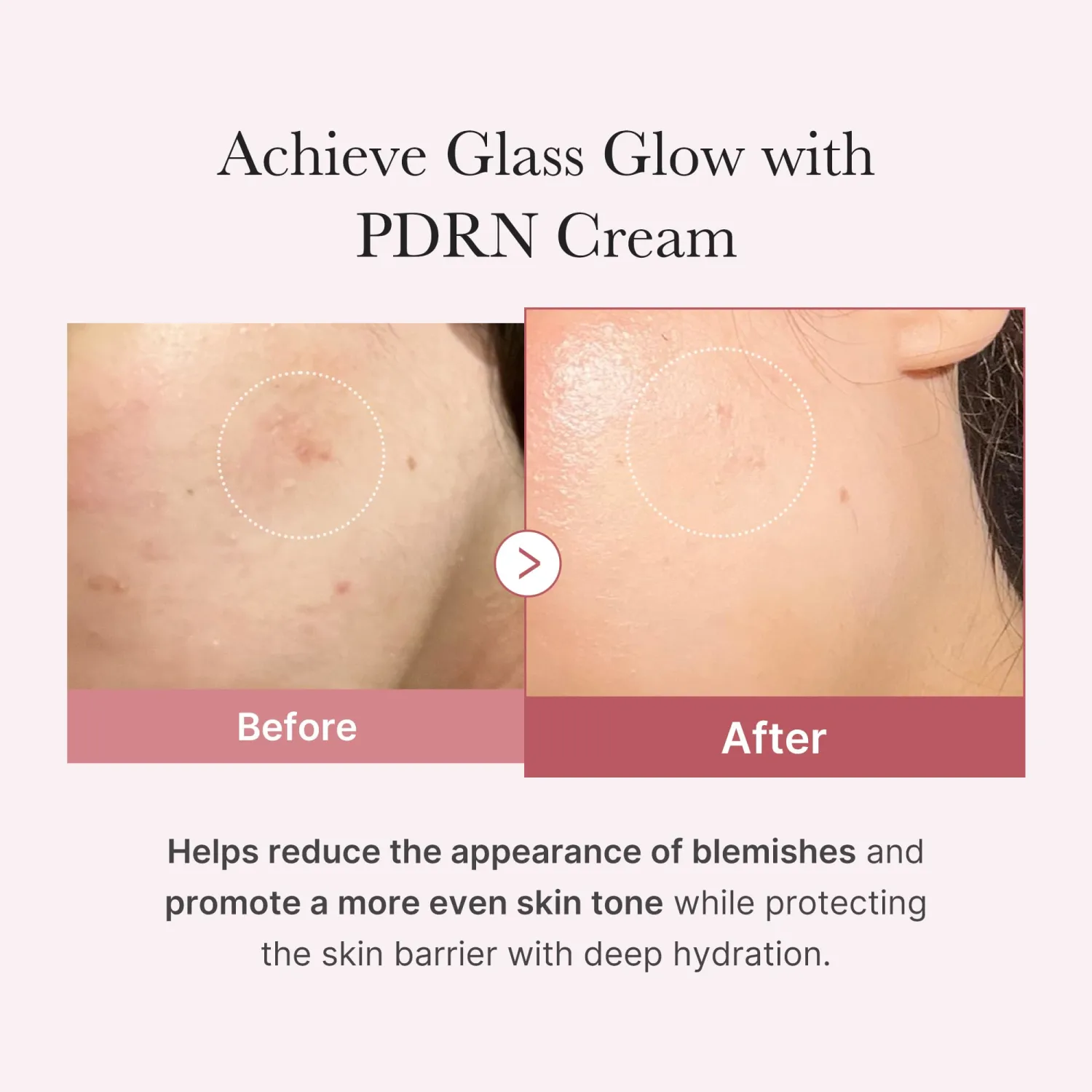 medicube Salmon DNA PDRN Pink Hyaluronic Moisturizing Cream
