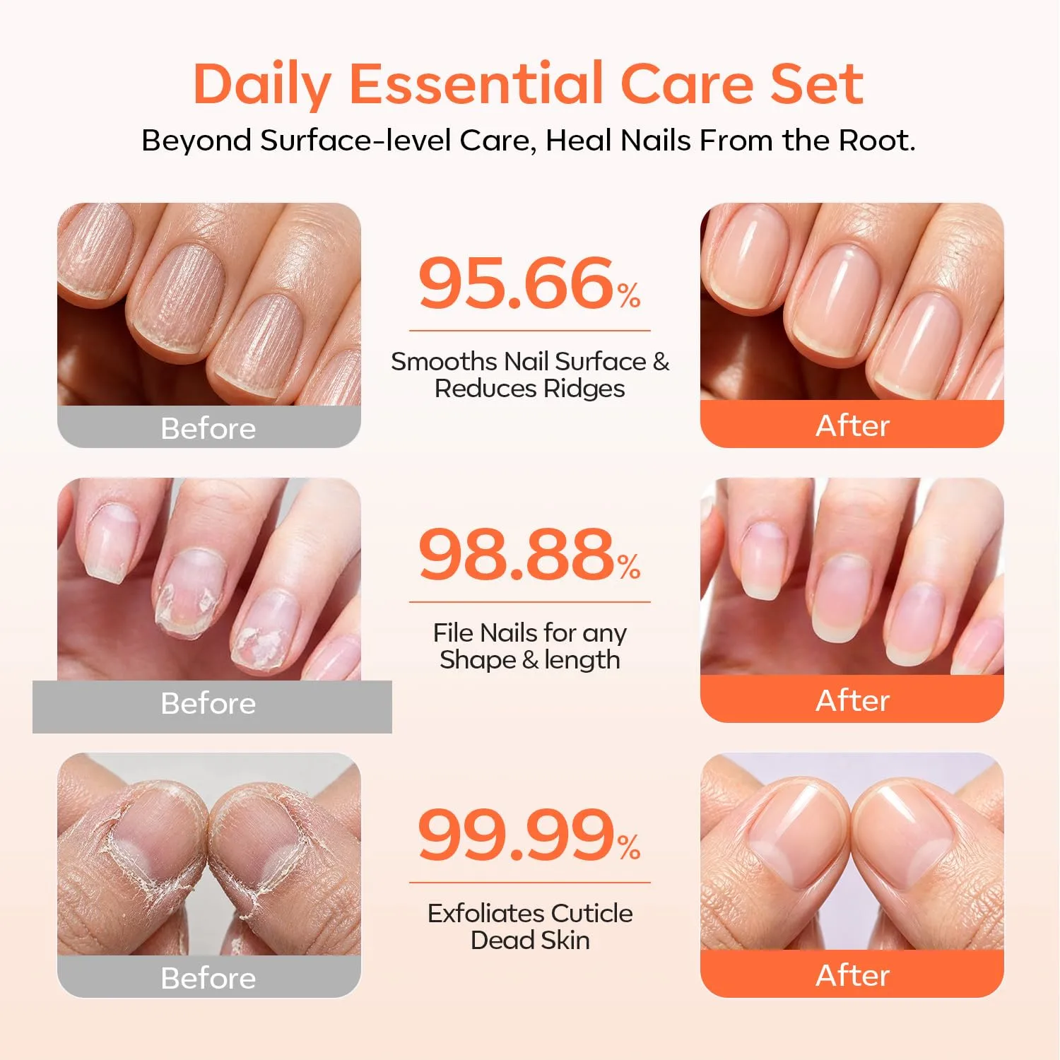 Modelones Cuticle Remover Kit, Cuticle Trimmer Nail Stuff & File Nail Kit
